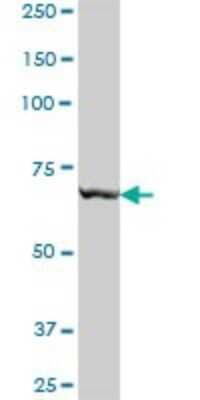 Western Blot: Arginyl tRNA synthetase Antibody [H00005917-B01P] - Analysis of RARS expression in human placenta.