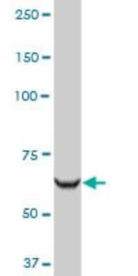 Western Blot: Arginyl tRNA synthetase Antibody [H00005917-D01P] - Analysis of RARS expression in HepG2.