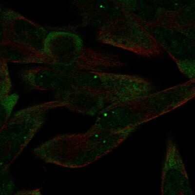 Immunocytochemistry/Immunofluorescence: Argonaute 4 Antibody [NBP2-57022] - Staining of human cell line RH-30 shows localization to nuclear bodies &amp; cytosol.