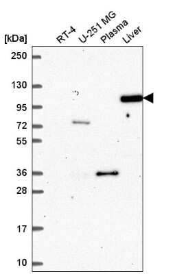 Western Blot: Argonaute 4 Antibody [NBP2-57022] - Western blot analysis in human cell line RT-4, human cell line U-251 MG, human plasma and human liver tissue.