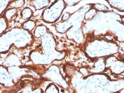 Immunohistochemistry-Paraffin: Aromatase Antibody (CYP19A1/4257) - Azide and BSA Free [NBP3-08711] - Formalin-fixed, paraffin-embedded human placenta stained with Aromatase Mouse Monoclonal Antibody (CYP19A1/4257).