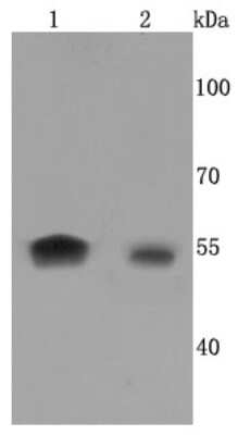 Western Blot: Aromatase Antibody (JM10-68) [NBP2-67166] - Analysis of Aromatase on different cells lysates using anti-Aromatase antibody at 1/500 dilution. Positive control: Lane 1: JAR Lane 2: Jurkat
