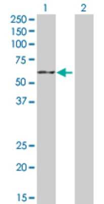 Western Blot: Aromatase Antibody [H00001588-D01P] - Analysis of CYP19A1 expression in transfected 293T cell line by CYP19A1 polyclonal antibody.Lane 1: CYP19A1 transfected lysate(57.90 KDa).Lane 2: Non-transfected lysate.
