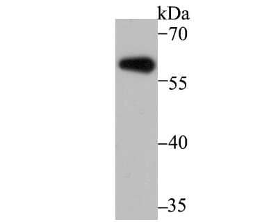 Western Blot: Aromatase Antibody [NBP2-80415] - Analysis of Aromatase on mouse cerebellum tissue lysate using anti-Aromatase antibody at 1/500 dilution.