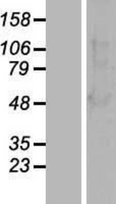 Western Blot beta-Arrestin 1 Overexpression Lysate