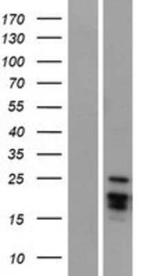 Western Blot: Artemin Overexpression Lysate (Adult Normal) [NBP2-05812] Left-Empty vector transfected control cell lysate (HEK293 cell lysate); Right -Over-expression Lysate for Artemin.