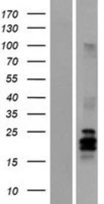 Western Blot: Artemin Overexpression Lysate (Adult Normal) [NBP2-05813] Left-Empty vector transfected control cell lysate (HEK293 cell lysate); Right -Over-expression Lysate for Artemin.