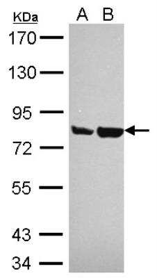 Western Blot: Artemis Antibody [NBP2-15477] - Sample (30 ug of whole cell lysate) A: Hela B: Hep 7.5% SDS PAGE  diluted at 1:1000