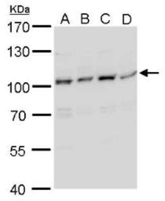 Western Blot: Artemis Antibody [NBP2-15477] - Artemis antibody detects Artemis protein by Western blot analysis. A. 30 ug A431 whole cell lysate/extract. B. 30 ug HeLa whole cell lysate/extract. C. 30ug HepG2 whole cell lysate/extract. 7.5 % SDS-PAGE. Artemis antibody dilution: 1:1000