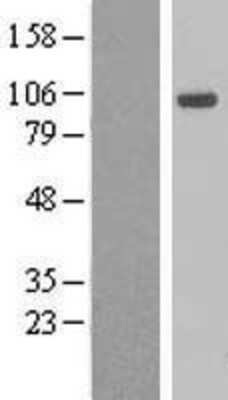 Western Blot: AHR Overexpression Lysate [NBL1-07403] -  Left-Control; Right -Over-expression Lysate for AHR