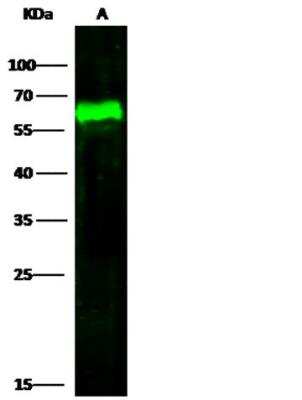 Western Blot: Arylsulfatase A/ARSA Antibody (001) [NBP2-89502] - Lane A: HepG2 Whole Cell Lysate Lysates/proteins at 30 ug per lane.Secondary Goat Anti-Rabbit IgG H&L (Dylight800) at 1/10000 dilution.Developed using the Odyssey technique. Performed under reducing conditions.Predicted band size:54 kDa Observed band size:60 kDa