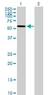 Western Blot: Arylsulfatase A/ARSA Antibody [H00000410-B01P] - Analysis of ARSA expression in transfected 293T cell line by ARSA polyclonal antibody.  Lane 1: ARSA transfected lysate(55.77 KDa). Lane 2: Non-transfected lysate.