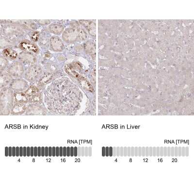 Immunohistochemistry-Paraffin: Arylsulfatase B/ARSB Antibody [NBP1-85879] - Staining in human kidney and liver tissues using anti-ARSB antibody. Corresponding ARSB RNA-seq data are presented for the same tissues.