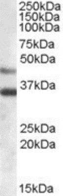 Western Blot: Arylsulfatase B/ARSB Antibody [NBP1-06021] - (0.03ug/ml) staining of Human Heart lysate (35ug protein in RIPA buffer). Primary incubation was 1 hour. Detected by chemiluminescence.