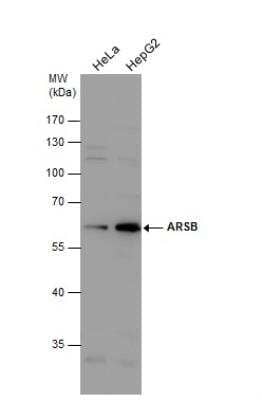 Western Blot: Arylsulfatase B/ARSB Antibody [NBP2-15474] - Various whole cell extracts (30 ug) were separated by 10% SDS-PAGE, and the membrane was blotted with ARSB antibody [N3C3] diluted at 1:1000.