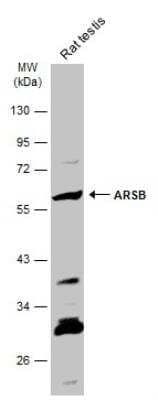 Western Blot: Arylsulfatase B/ARSB Antibody [NBP2-15474] - Rat tissue extract (50 ug) was separated by 10% SDS-PAGE, and the membrane was blotted with ARSB antibody diluted at 1:500.