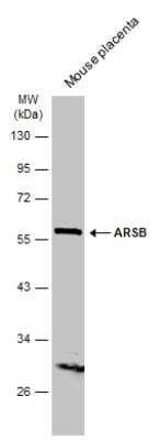 Western Blot: Arylsulfatase B/ARSB Antibody [NBP2-15474] - Mouse tissue extract (50 ug) was separated by 10% SDS-PAGE, and the membrane was blotted with ARSB antibody diluted at 1:500.