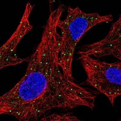 Immunocytochemistry/Immunofluorescence: Arylsulfatase D Antibody [NBP2-56968] - Staining of human cell line A549 shows localization to lipid droplets.