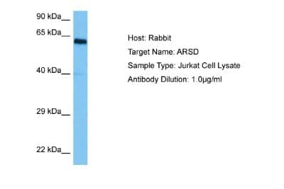 Western Blot: Arylsulfatase D Antibody [NBP2-87043] - Host: Rabbit. Target Name: ARSD. Sample Tissue: Human Jurkat Whole Cell lysates. Antibody Dilution: 1ug/ml