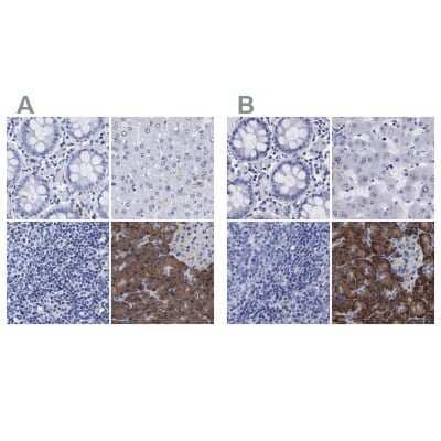 <b>Independent Antibodies Validation. </b>Immunohistochemistry-Paraffin: Arylsulfatase G/ARSG Antibody [NBP1-82947] - Staining of human colon, liver, lymph node and pancreas using Anti-ARSG antibody NBP1-82947 (A) shows similar protein distribution across tissues to independent antibody NBP1-82948 (B).