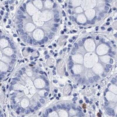 Immunohistochemistry-Paraffin: Arylsulfatase G/ARSG Antibody [NBP1-82947] - Staining of human colon.