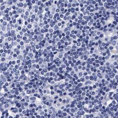 Immunohistochemistry-Paraffin: Arylsulfatase G/ARSG Antibody [NBP1-82947] - Staining of human lymph node.