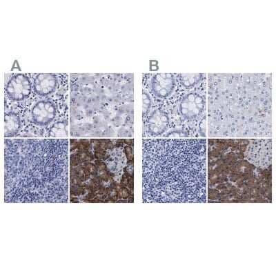 <b>Independent Antibodies Validation. </b>Immunohistochemistry-Paraffin: Arylsulfatase G/ARSG Antibody [NBP1-82948] - Staining of human colon, liver, lymph node and pancreas using Anti-ARSG antibody NBP1-82948 (A) shows similar protein distribution across tissues to independent antibody NBP1-82947 (B).