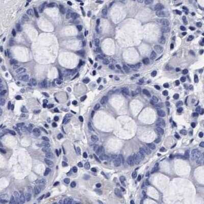 Immunohistochemistry-Paraffin: Arylsulfatase G/ARSG Antibody [NBP1-82948] - Staining of human colon.