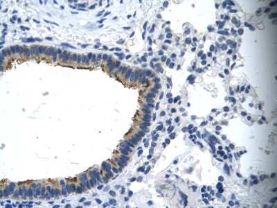 Immunohistochemistry: Asialoglycoprotein Receptor 2 Antibody [NBP1-52958] - Human cilia Cellular data: Epithelial cells of renal tubule Antibody Concentration: 4.0-8.0 ug/ml Magnification: 400X.