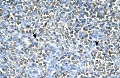 Immunohistochemistry: Asialoglycoprotein Receptor 2 Antibody [NBP1-54888] - Human Spleen stained with Asialoglylcoprotein Receptor 2 antibody.