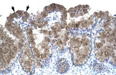 Immunohistochemistry-Paraffin: Asialoglycoprotein Receptor 2 Antibody [NBP1-52958] - Human Intestine Tissue, antibody concentration 4-8ug/ml. Cells with positive label: Epithelial cells of intestinal villus (indicated with arrows) 400X magnification.