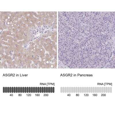 Immunohistochemistry-Paraffin: Asialoglycoprotein Receptor 2 Antibody [NBP1-85578] - Staining in human liver and pancreas tissues using anti-ASGR2 antibody. Corresponding ASGR2 RNA-seq data are presented for the same tissues.