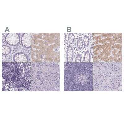 <b>Independent Antibodies Validation and Orthogonal Strategies Validation.</b>Immunohistochemistry-Paraffin: Asialoglycoprotein Receptor 2 Antibody [NBP1-85578] - Staining of human colon, liver, lymph node and pancreas using Anti-ASGR2 antibody NBP1-85578 (A) shows similar protein distribution across tissues to independent antibody NBP1-85579 (B).