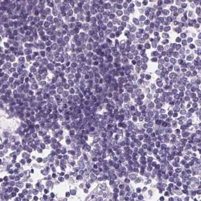 Immunohistochemistry-Paraffin: Asialoglycoprotein Receptor 2 Antibody [NBP1-85578] - Staining of human lymph node.