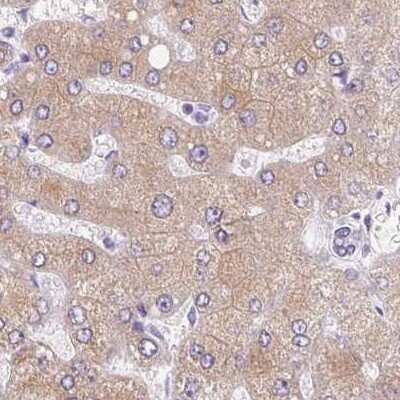 Immunohistochemistry-Paraffin: Asialoglycoprotein Receptor 2 Antibody [NBP1-85578] - Staining of human liver using Anti-ASGR2 antibody NBP1-85578.