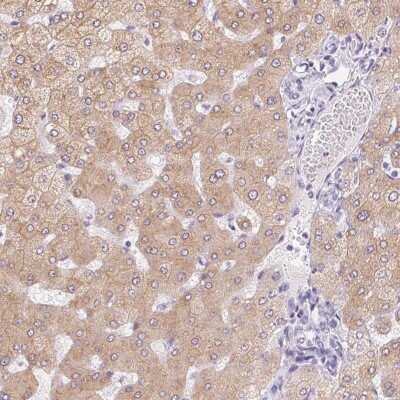 Immunohistochemistry-Paraffin: Asialoglycoprotein Receptor 2 Antibody [NBP1-85579] - Staining of human liver shows high expression.