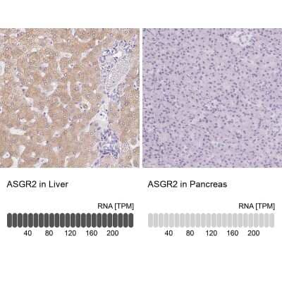 Immunohistochemistry-Paraffin: Asialoglycoprotein Receptor 2 Antibody [NBP1-85579] - Staining in human liver and pancreas tissues using anti-ASGR2 antibody. Corresponding ASGR2 RNA-seq data are presented for the same tissues.