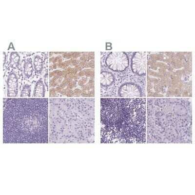 <b>Independent Antibodies Validation and Orthogonal Strategies Validation.</b>Immunohistochemistry-Paraffin: Asialoglycoprotein Receptor 2 Antibody [NBP1-85579] - Staining of human colon, liver, lymph node and pancreas using Anti-ASGR2 antibody NBP1-85579 (A) shows similar protein distribution across tissues to independent antibody NBP1-85578 (B).