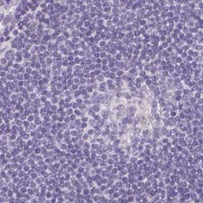 Immunohistochemistry-Paraffin: Asialoglycoprotein Receptor 2 Antibody [NBP1-85579] - Staining of human lymph node.