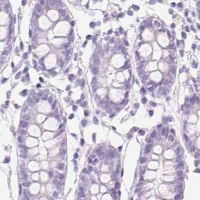 Immunohistochemistry-Paraffin: Asialoglycoprotein Receptor 2 Antibody [NBP1-85579] - Staining of human colon.