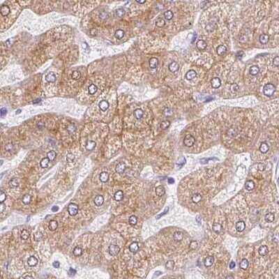 Immunohistochemistry-Paraffin: Asialoglycoprotein Receptor 2 Antibody [NBP1-85579] - Staining of human liver using Anti-ASGR2 antibody NBP1-85579.