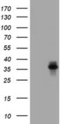 Western Blot: Asialoglycoprotein Receptor 2 Antibody (OTI2A12) - Azide and BSA Free [NBP2-70212] - Analysis of HEK293T cells were transfected with the pCMV6-ENTRY control (Left lane) or pCMV6-ENTRY Asialoglycoprotein receptor 2.