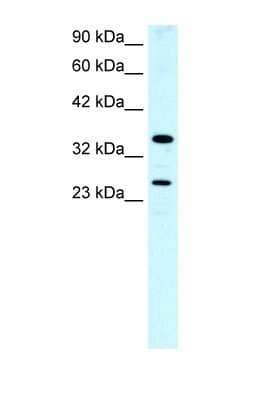 Western Blot: Asialoglycoprotein Receptor 2 Antibody [NBP1-52958] - Fetal Lung tissue at a concentration of 0.5ug/ml.