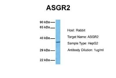 Western Blot: Asialoglycoprotein Receptor 2 Antibody [NBP1-54888] - Human HepG2 cell lysate. Antibody at 1.0 ug/mL.