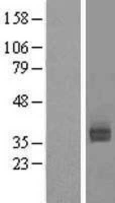 Western Blot: Asialoglycoprotein Receptor 2 Overexpression Lysate (Adult Normal) [NBL1-07763] Left-Empty vector transfected control cell lysate (HEK293 cell lysate); Right -Over-expression Lysate for Asialoglycoprotein Receptor 2.