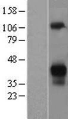 Western Blot: Asialoglycoprotein Receptor 2 Overexpression Lysate (Adult Normal) [NBL1-07764] Left-Empty vector transfected control cell lysate (HEK293 cell lysate); Right -Over-expression Lysate for Asialoglycoprotein Receptor 2.