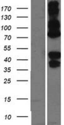 Western Blot: Asialoglycoprotein Receptor 2 Overexpression Lysate (Adult Normal) [NBP2-05750] Left-Empty vector transfected control cell lysate (HEK293 cell lysate); Right -Over-expression Lysate for Asialoglycoprotein Receptor 2.