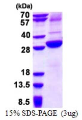 SDS-Page: Recombinant Human Asialoglycoprotein Receptor 2 Protein [NBP2-22697]