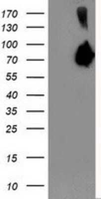 Western Blot: Asparagine synthetase Antibody (1A10) [NBP2-01159] - HEK293T cells were transfected with the pCMV6-ENTRY control (Left lane) or pCMV6-ENTRY Asparagine synthetase (Right lane) cDNA for 48 hrs and lysed. Equivalent amounts of cell lysates (5 ug per lane) were separated by SDS-PAGE and immunoblotted with anti-Asparagine synthetase.