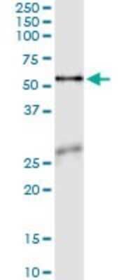 Immunoprecipitation: Asparagine synthetase Antibody (2B3) [H00000440-M02] - Analysis of ASNS transfected lysate using anti-ASNS monoclonal antibody and Protein A Magnetic Bead, and immunoblotted with ASNS MaxPab rabbit polyclonal antibody.